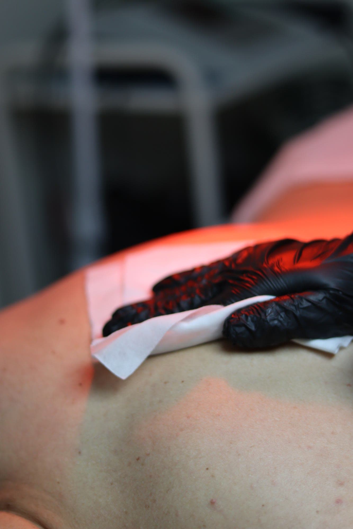 Désinfection de la peau avant la pose des ventouses