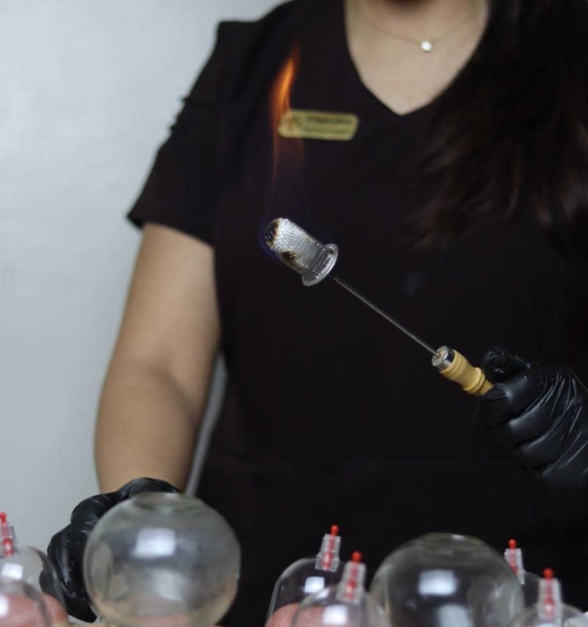 Praticienne préparant une ventouse à feu