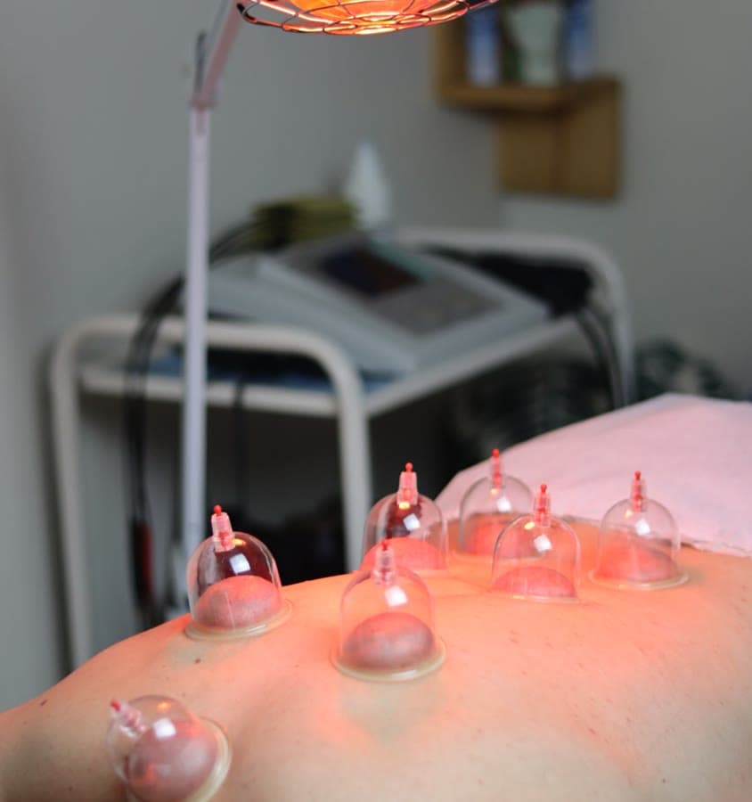 Ventouses sur le dos d'un patient sous une lampe infrarouge