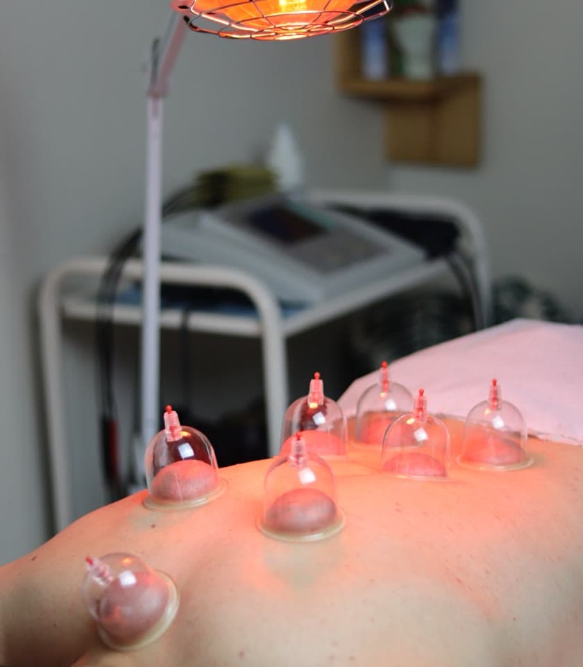 Ventouses posées sur le dos sous une lampe infrarouge