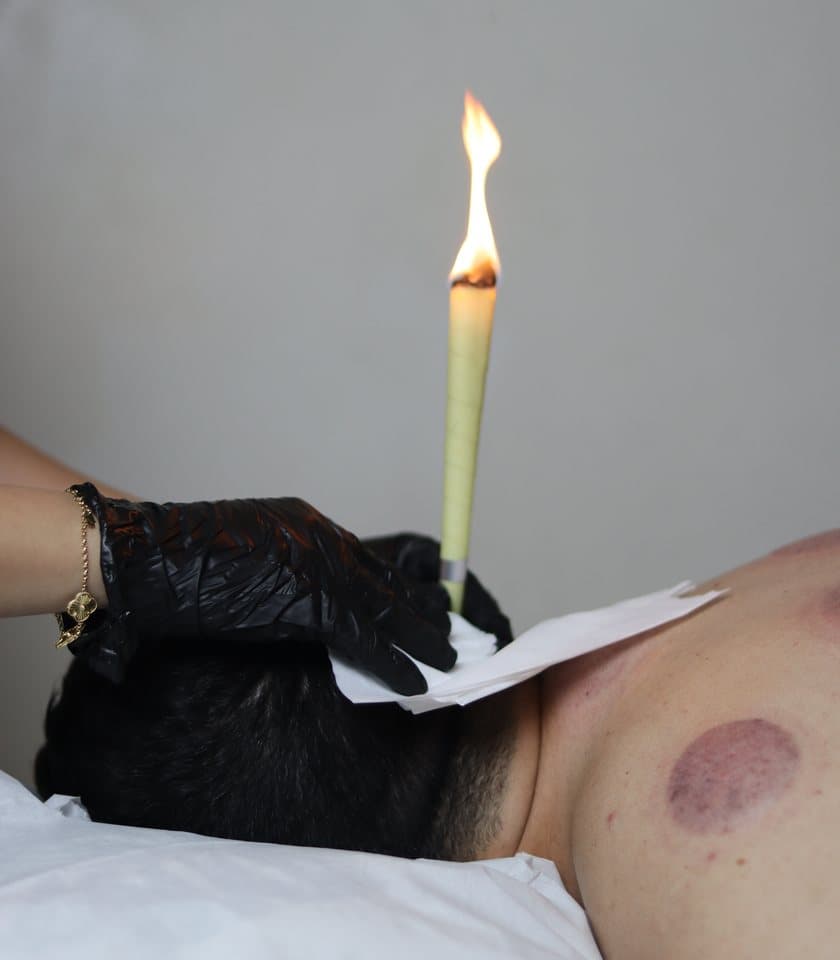 Bougie auriculaire allumée pendant une séance